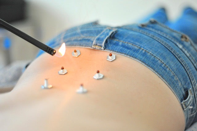 Treating Chronic Pain with Acupuncture’s Extraordinary Vessels - In Person Workshop